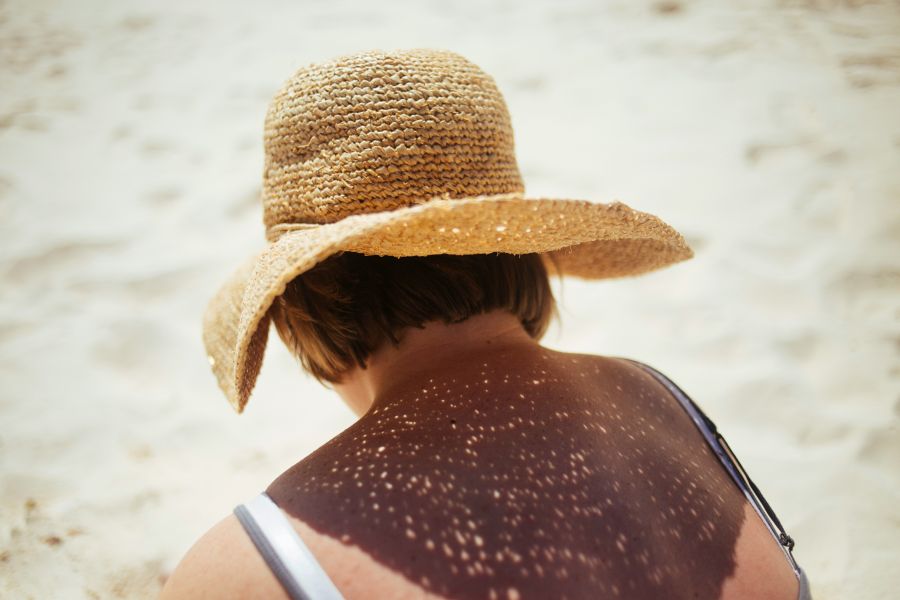 protectores solares